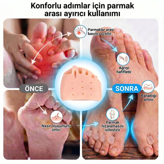 Flexifoot Silikon Ayak Pedi